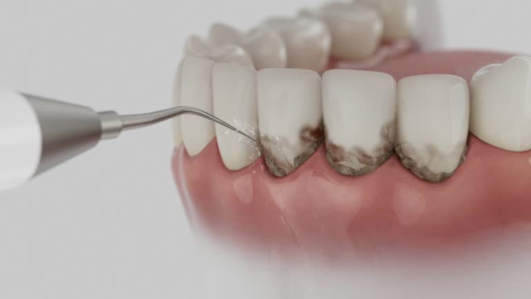 Reliable Dental contractor in Hudson Falls, NY by Smile Center Dentistry